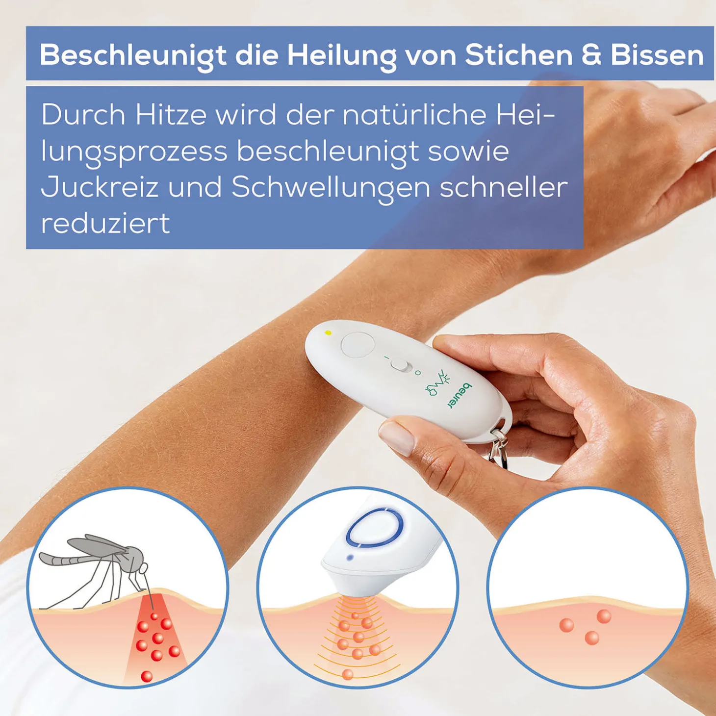 Beurer Insektenstichheiler