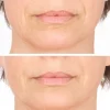 Vitame Collagen Plus Kapseln